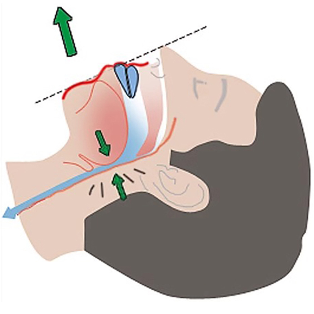 New White Box Anti-Snoring Sle - Dental Guard Night recension och pris