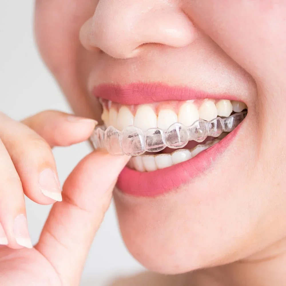 1-4Pc Anti Snoring Bruxism Sle - Dental Guard Night recension och pris