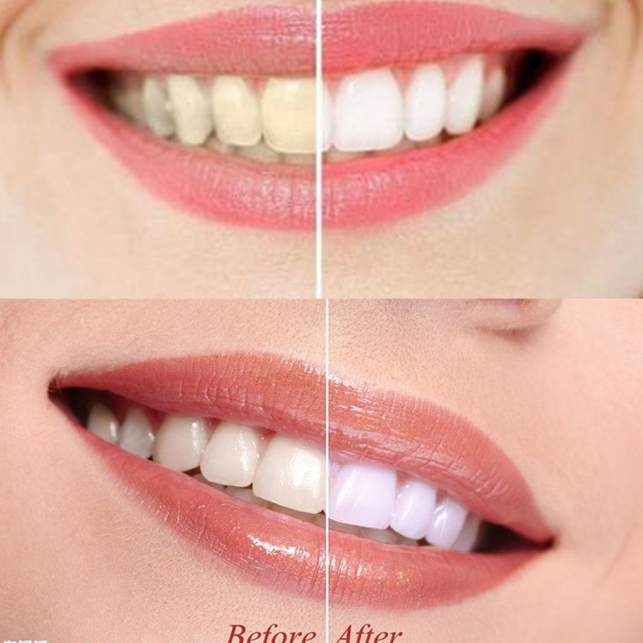 Bamboo Charcoal Teeth Tooth De - Teeth Whitening Quotes recension och pris