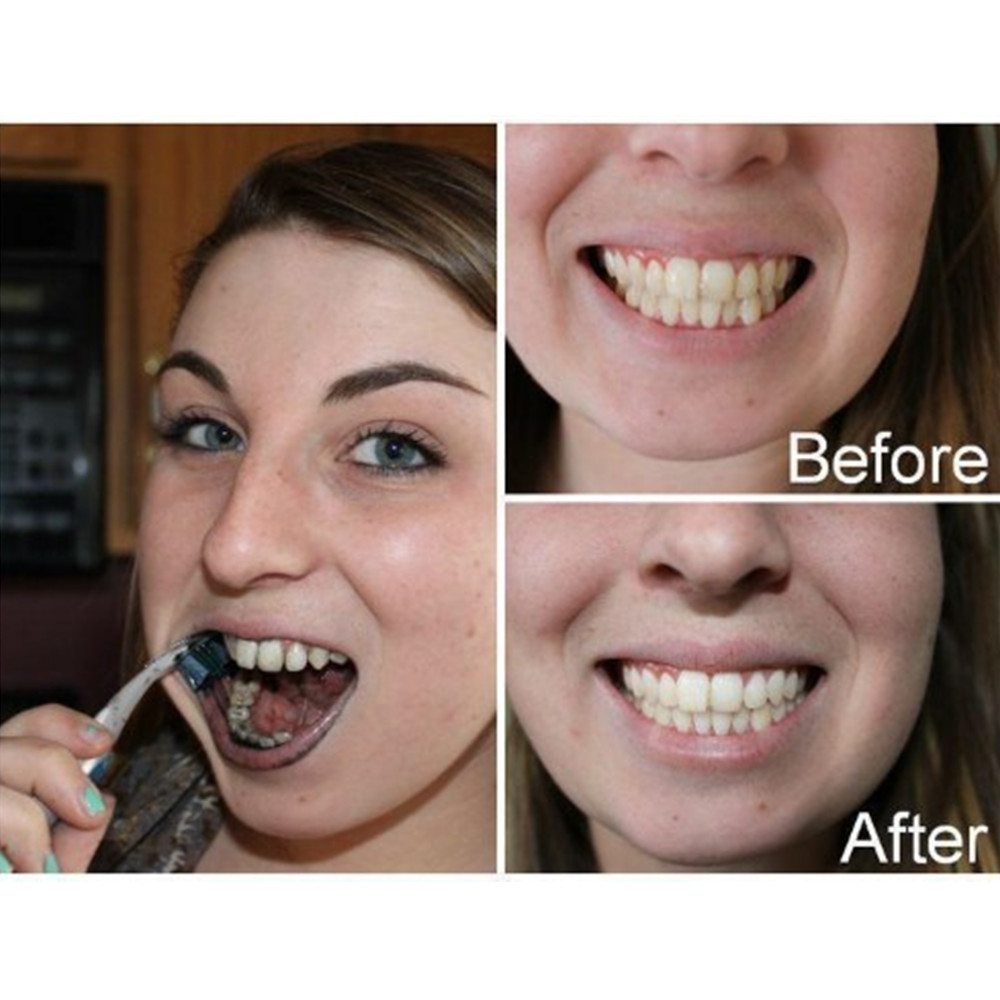 Bamboo Charcoal Teeth Tooth De - Teeth Whitening Quotes recension och pris