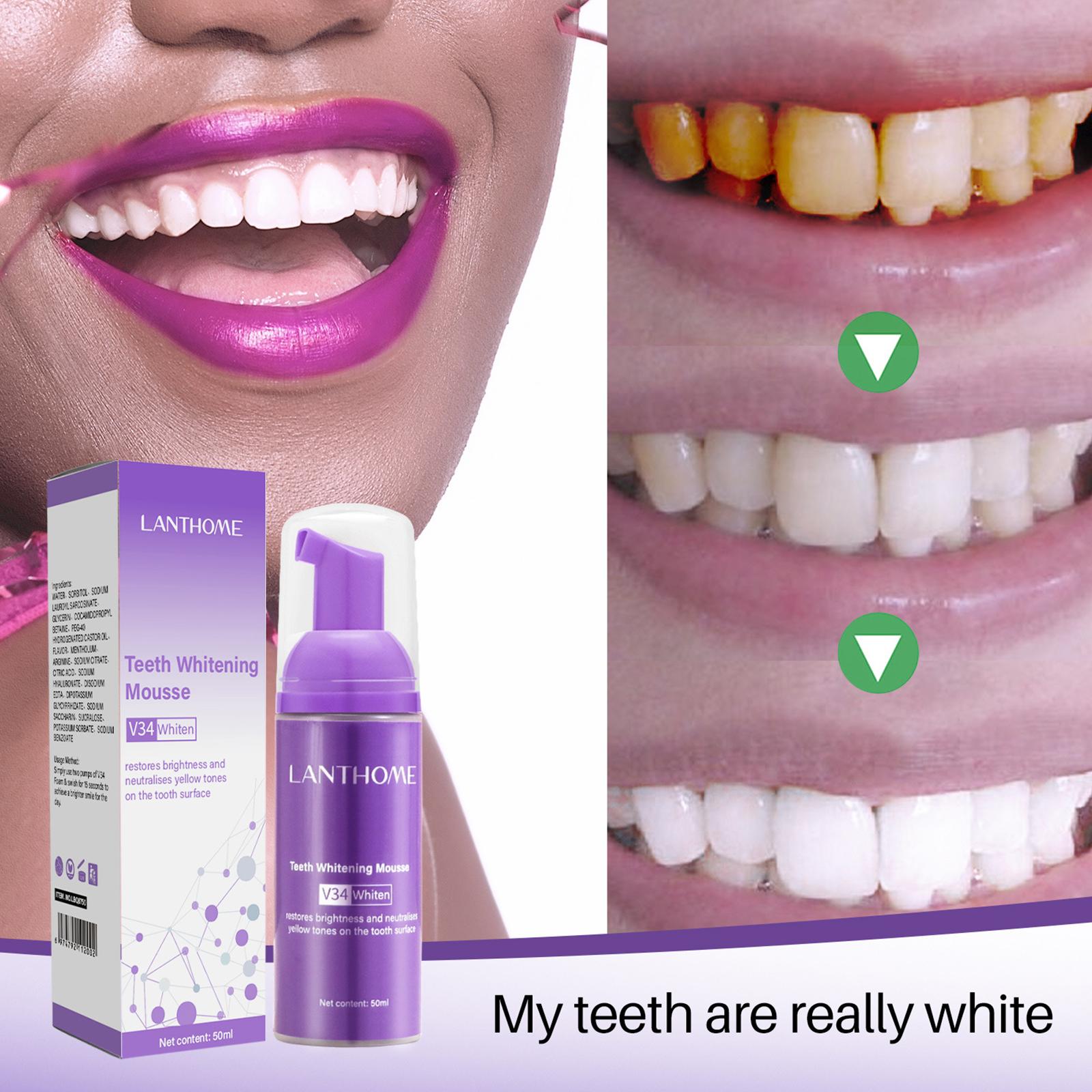 V34 Mousse Teeth Cleaning Toot - Teeth Whitening Crest recension och pris