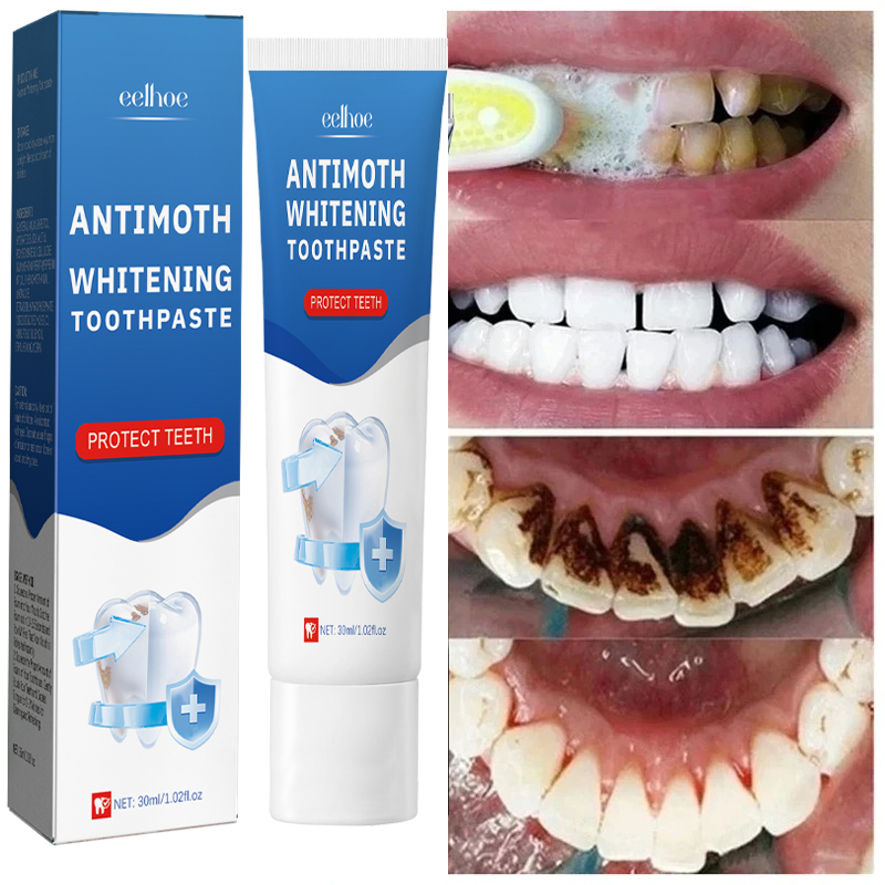 Fast Remove Smoke Stains Tooth - Teeth Whitening Fast recension och pris