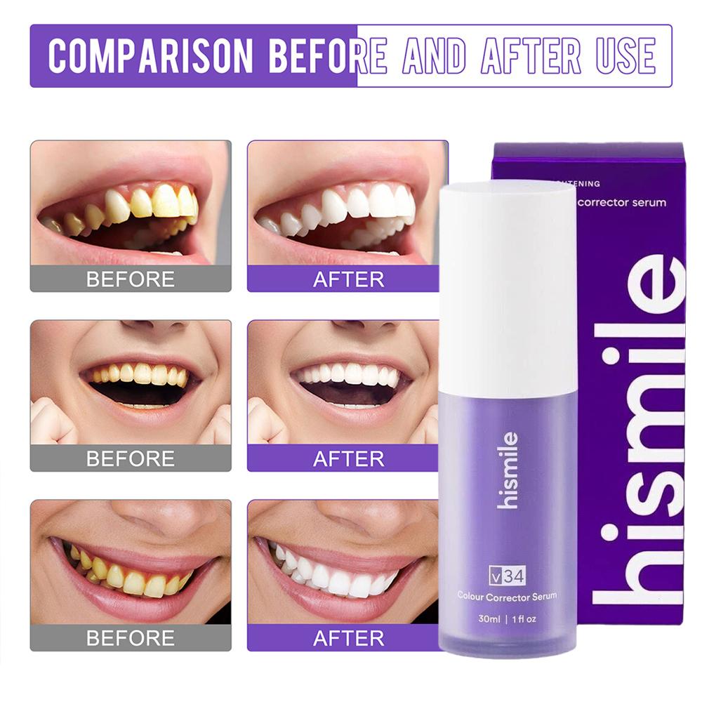  Purple V34 Hismile Teeth Bri - Teeth Whitening Crest recension och pris