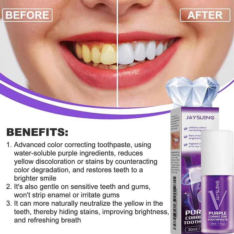 Teeth Cleansing Whitening Toot - Teeth Whitening In Korea recension och pris