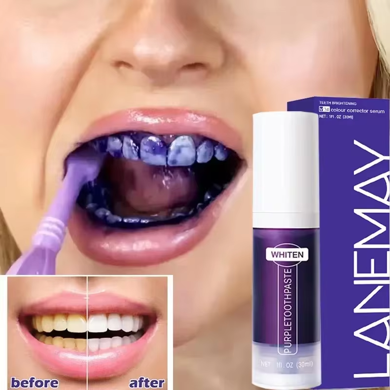 V34 Purple Teeth Whitening Too - Teeth Whitening Crest recension och pris
