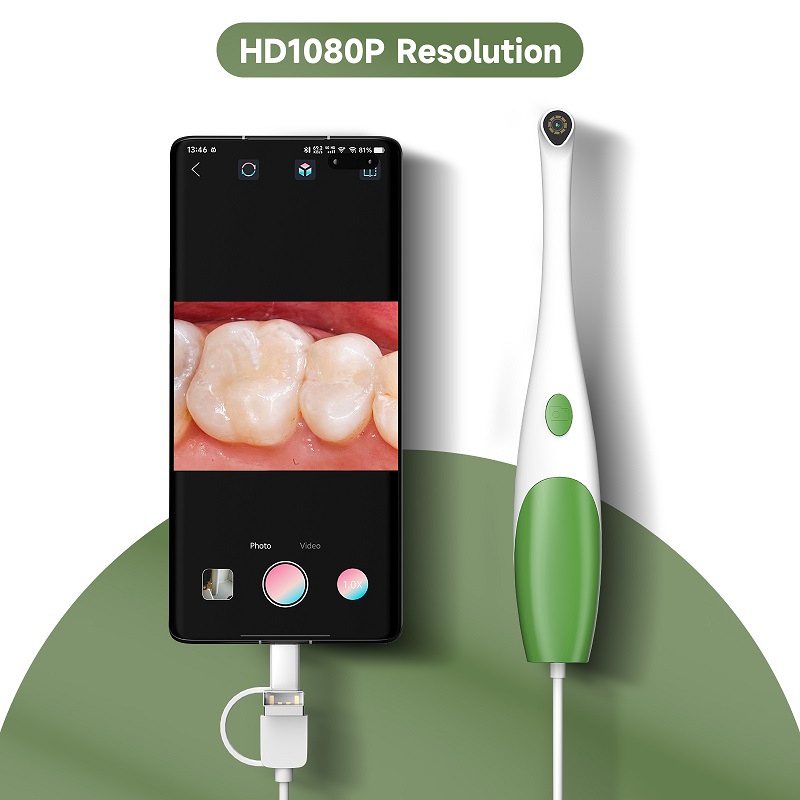 TYPE-C Oral Endoscope Handheld - Teeth Whitening Video recension och pris