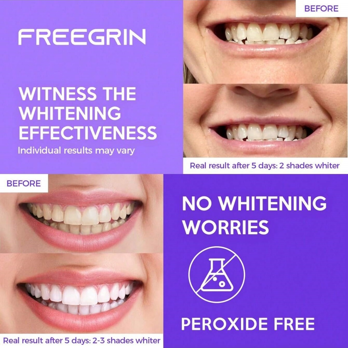 Deluxe Whitening Teeth Sticker - Teeth Whitening Quotes recension och pris