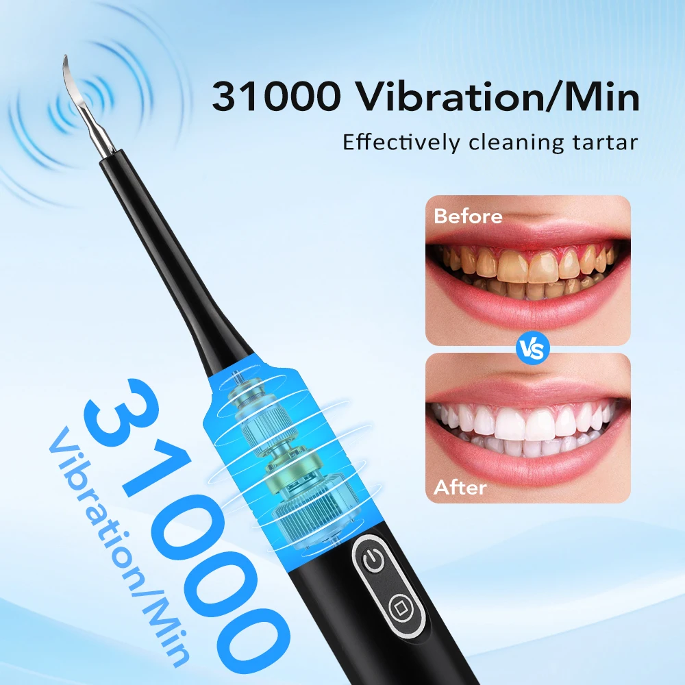 Electric Sonic Vibration Denta - Whitening Teeth Dentist recension och pris